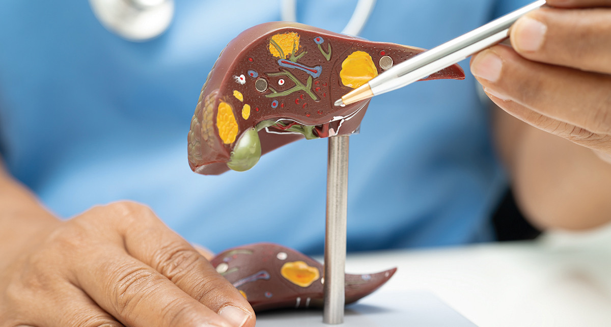 How to overcome fatty liver disease